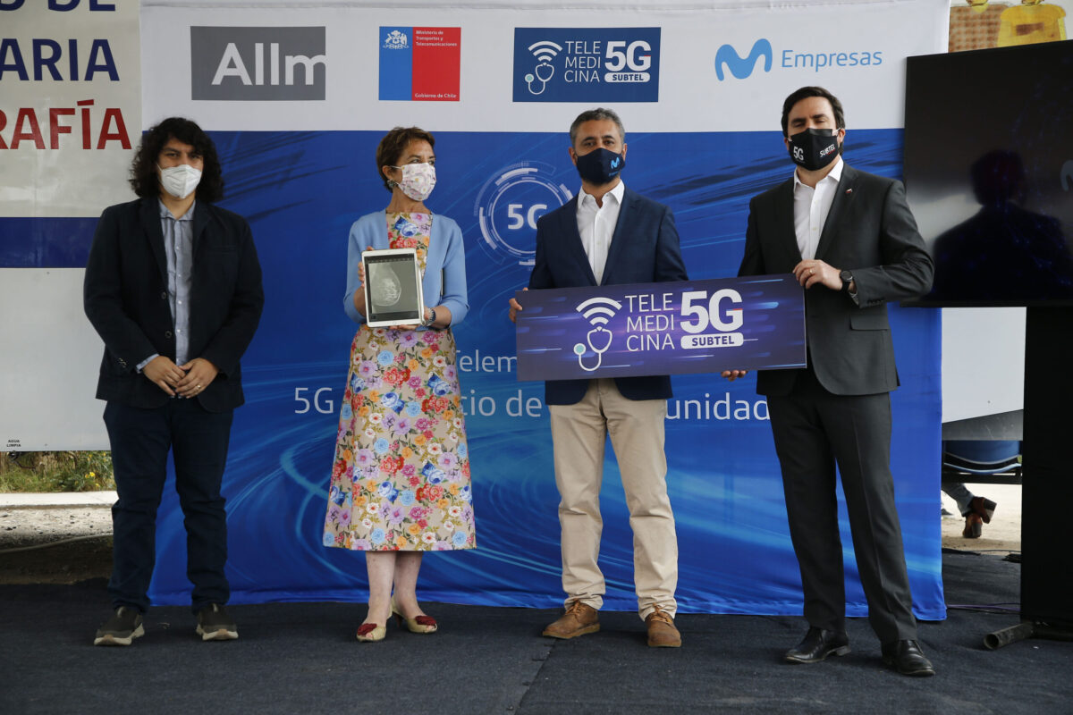 Chile realizó la primera mamografía remota con 5G de la región